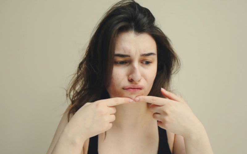 【萊沃醫(yī)療：知識分享】關(guān)于痘印修復(fù)，90%的人都做錯了